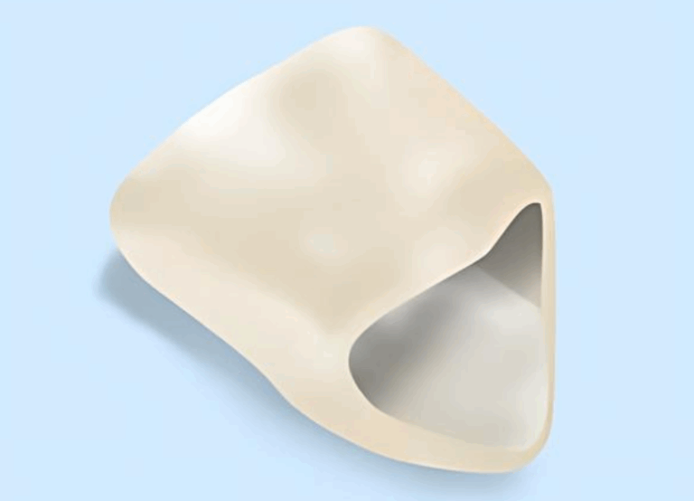 ハイブリッドセラミック|ワンズ歯科