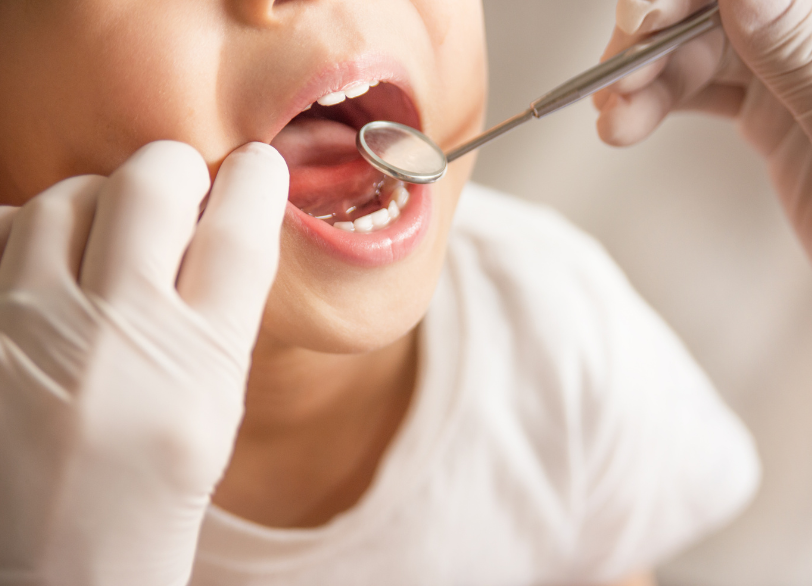 お子様の気持ちに寄り添う治療|ワンズ歯科