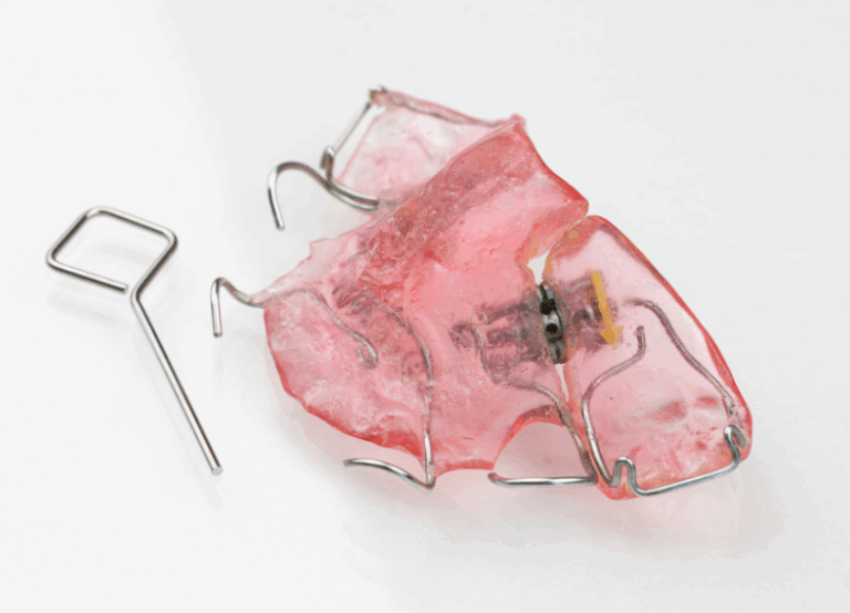 床矯正|ワンズ歯科