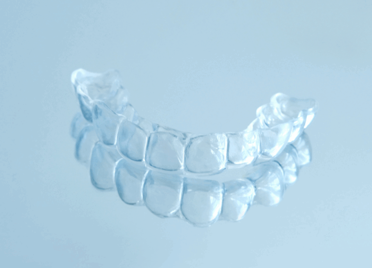 2期治療|ワンズ歯科