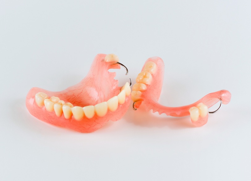 レジン床義歯|ワンズ歯科