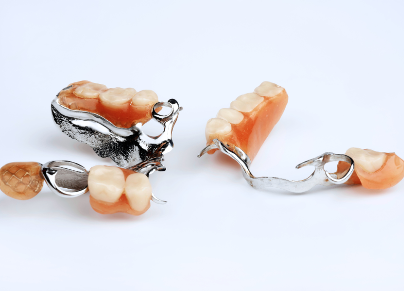 金属床義歯|ワンズ歯科