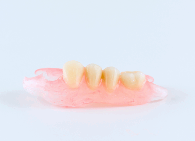 ノンクラスプデンチャー|ワンズ歯科