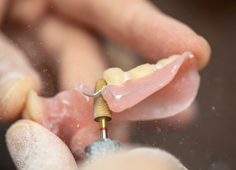 歯科医師 歯科技工士との連携|ワンズ歯科