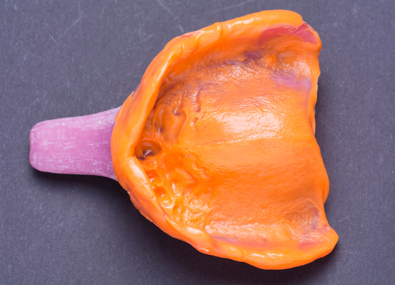 個人トレー|ワンズ歯科