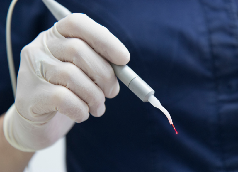 歯科用レーザー|ワンズ歯科