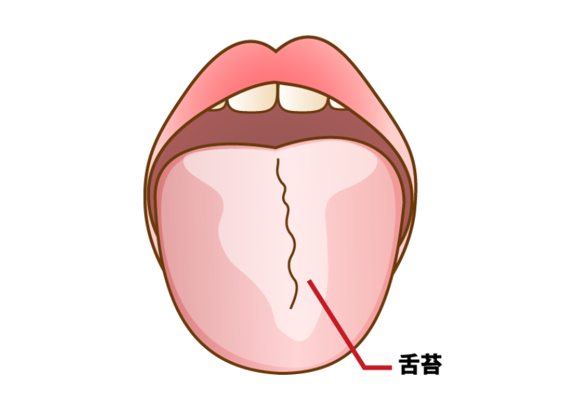 舌苔|ワンズ歯科