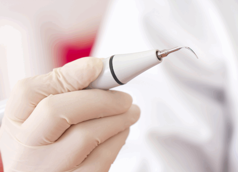 超音波スケーラー|ワンズ歯科