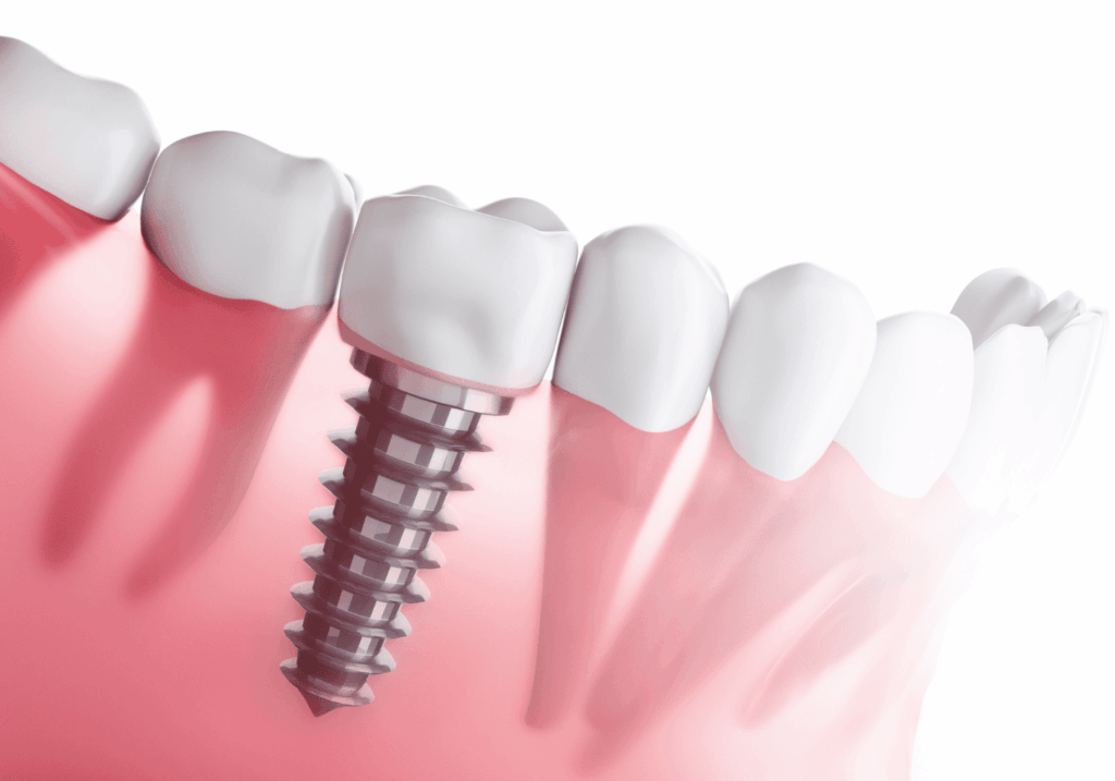 トップ16|ワンズ歯科