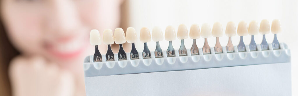 ホワイトニングを受ける前に|ワンズ歯科