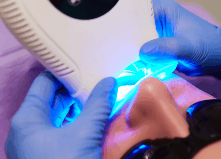 オフィスホワイトニング|ワンズ歯科