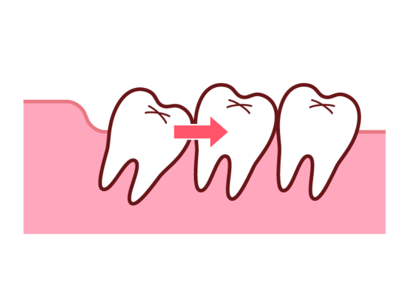 横や斜めに生えてくる|ワンズ歯科