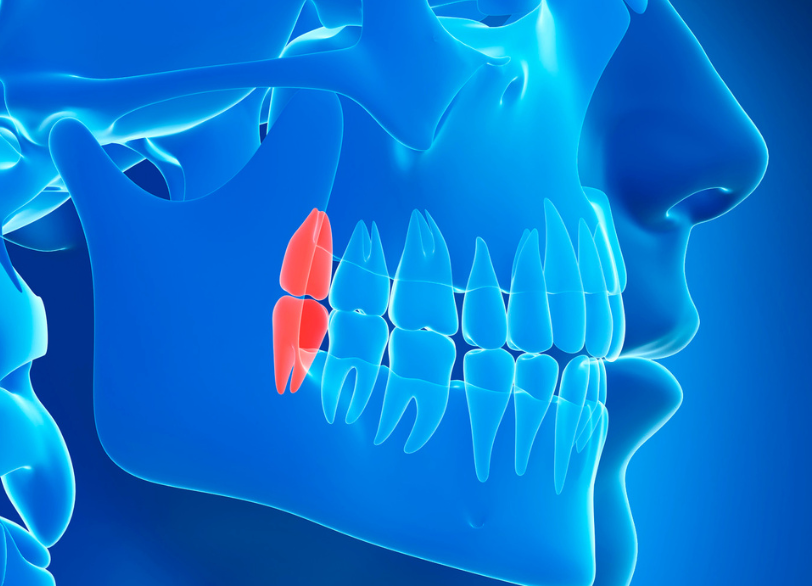 親知らずとは|ワンズ歯科