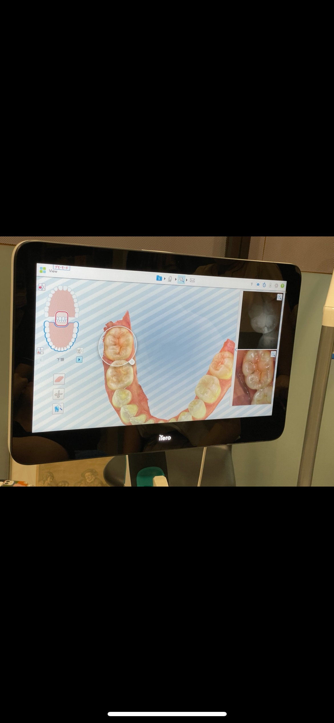 皆様の診療に使用していくのが楽しみです(^O^)/