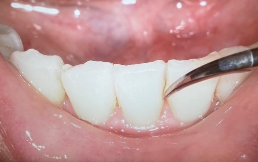 通常のカメラよりとても鮮明に写っております☆