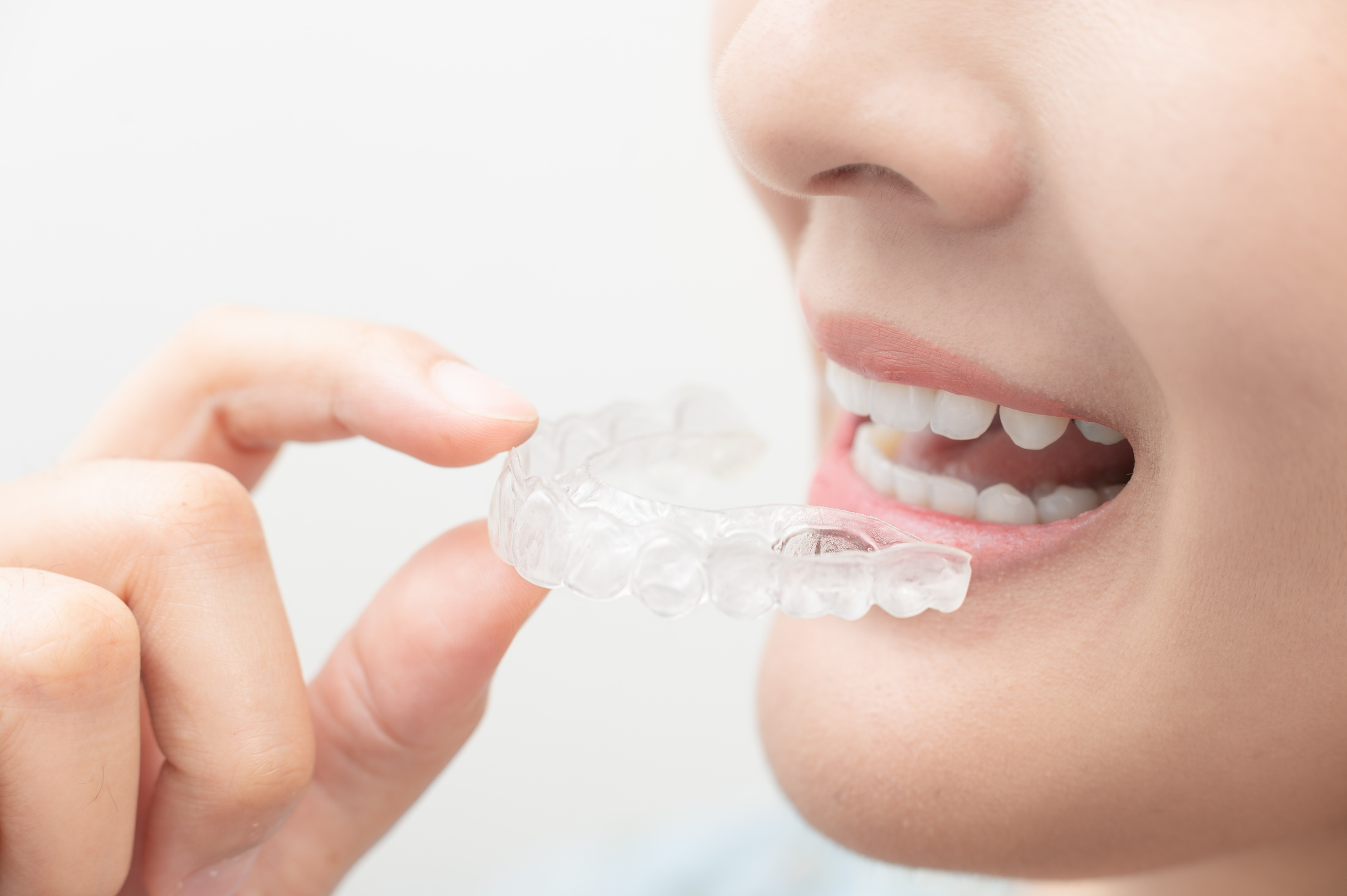 こんにちは。茨城県取手市にある歯医者「One's歯科クリニック」です。