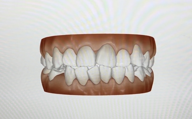 矯正したいが何から始めたらいいか、少し矯正に興味あるという方の為に当医院では【矯