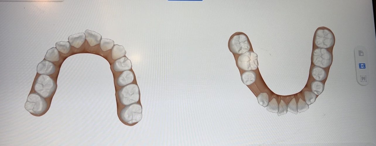 お顔全体の顔貌の変化なども確認することのできる最先端の治療機材も導入させて頂いて