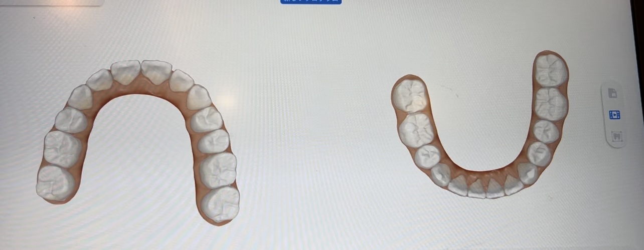 お顔全体の顔貌の変化なども確認することのできる最先端の治療機材も導入させて頂いて