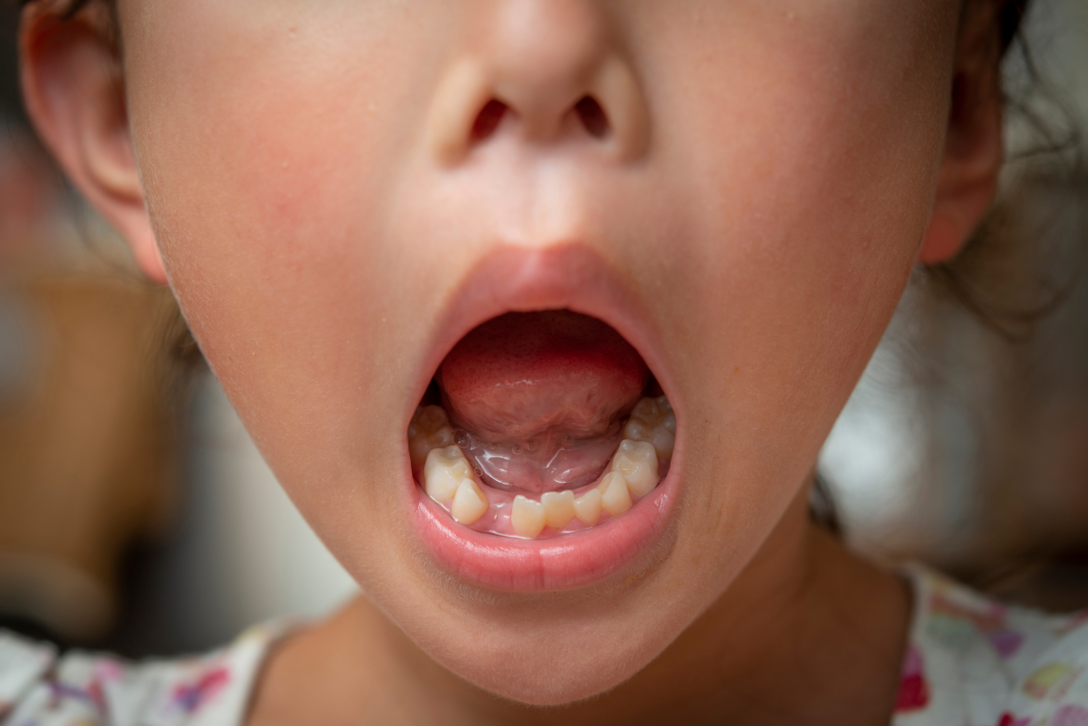 子どもの歯並びについて