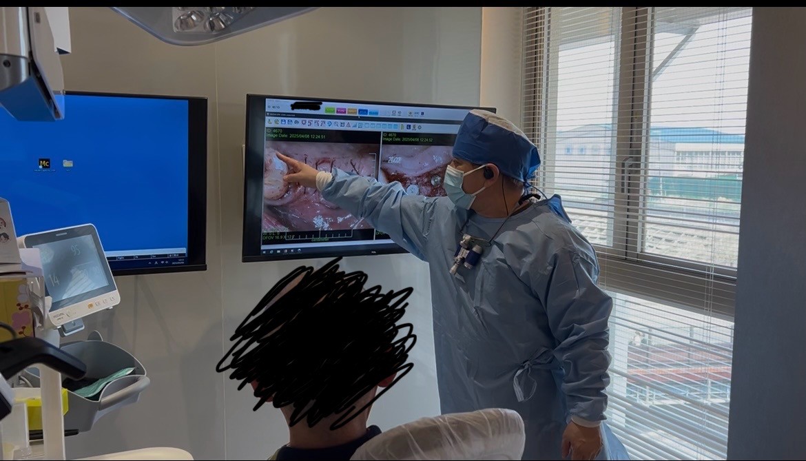 インプラントのご相談、ご連絡お待ちしております。