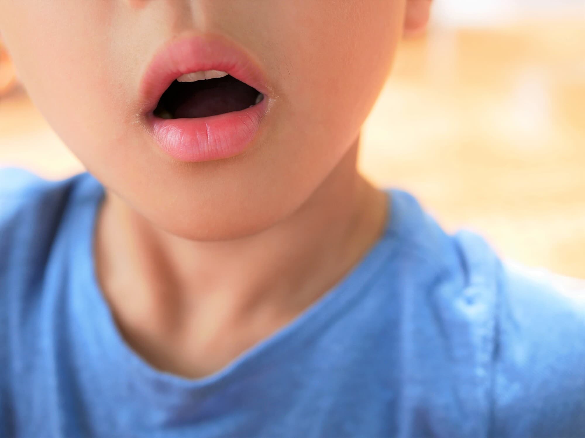 子どもの歯並びが悪くなる癖や習慣とは