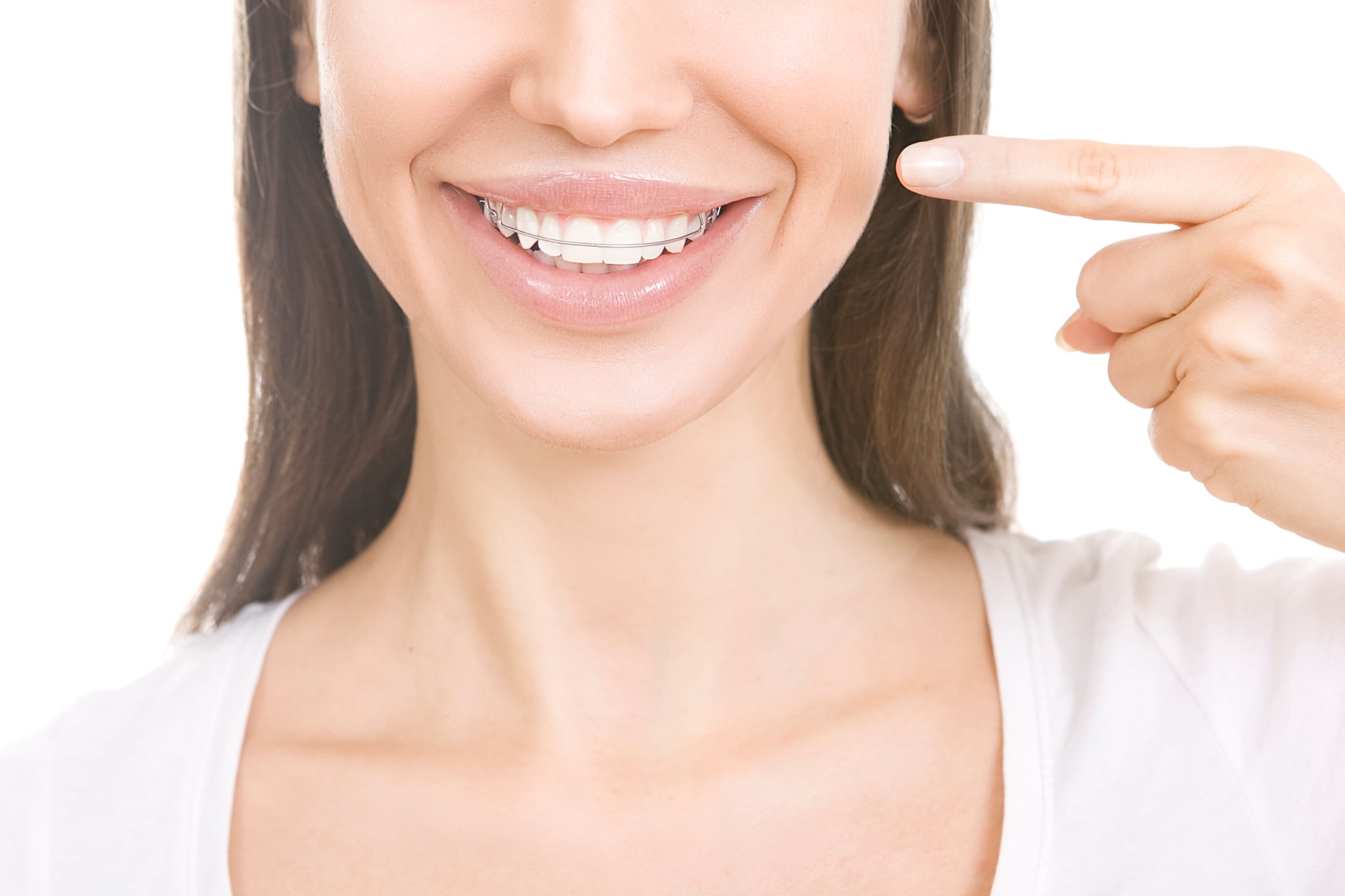 マウスピース矯正後の後戻りを防ぐために大切なこと